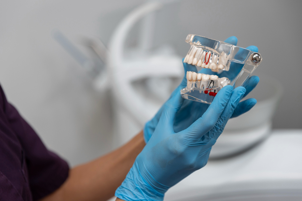 İmplant Tedavisinin Avantajları